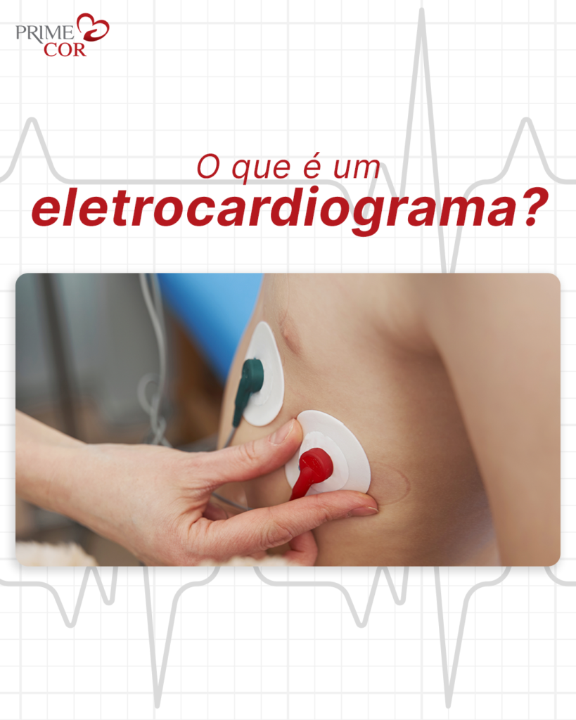 O que é um eletrocardiograma?