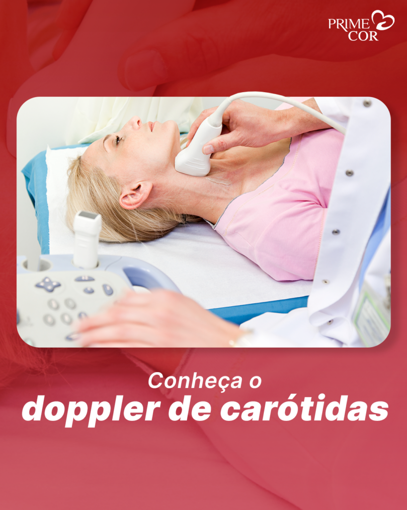 Conheça o doppler de carótidas