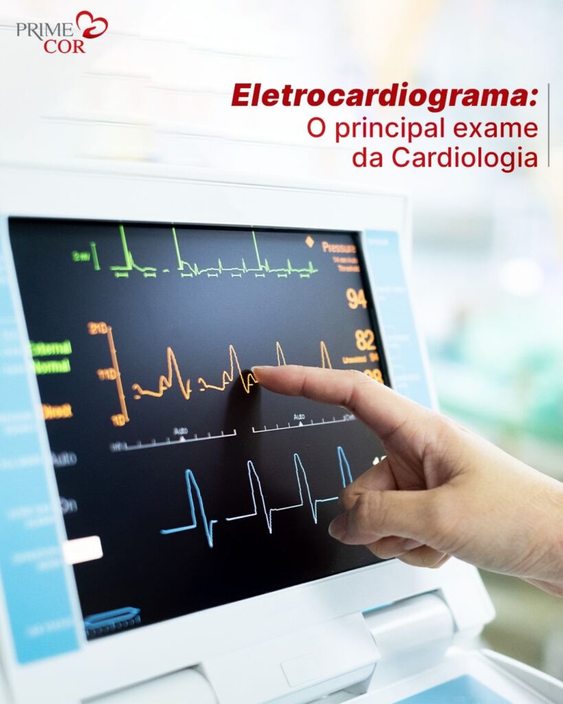 Eletrocardiograma: o principal exame da cardiologia