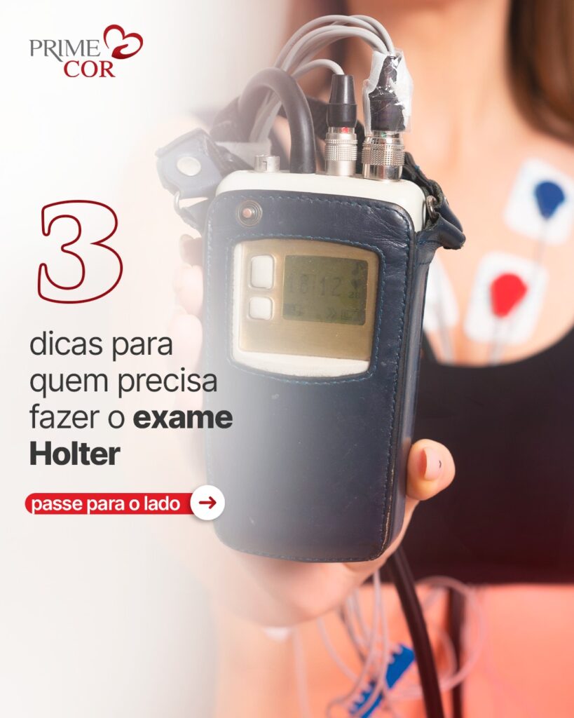 3 dicas pra quem precisa fazer o exame Holter