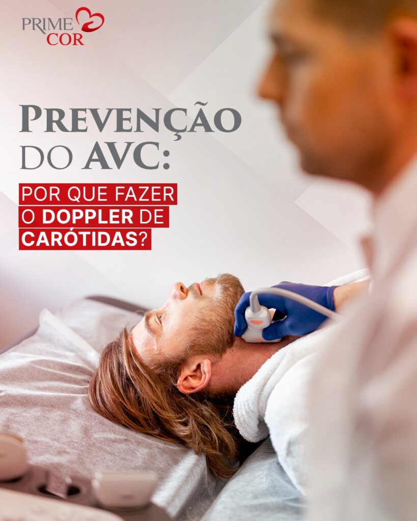 Prevenção do AVC: Por que fazer o Doppler de Carótidas?